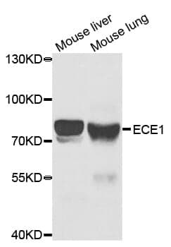 Anti-ECE1 Antibody