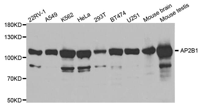 Anti-AP2B1 Antibody