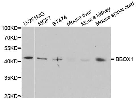Anti-BBOX1 Antibody