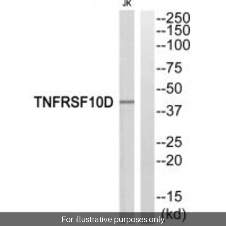 Anti-TNFRSF10D Antibody