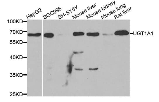 Anti-UGT1A1 Antibody