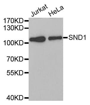 Anti-SND1 Antibody