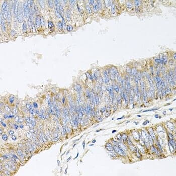 Anti-GP2 Antibody
