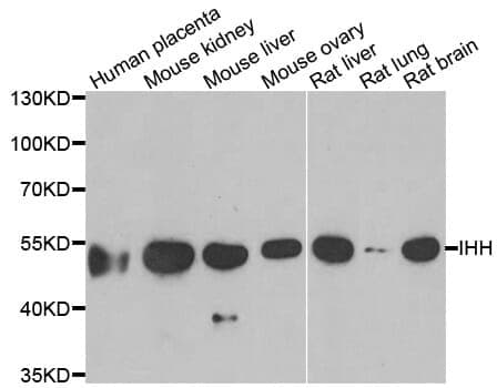 Anti-IHH Antibody