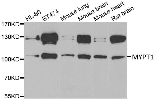 Anti-MYPT1 Antibody