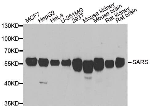 Anti-SARS Antibody