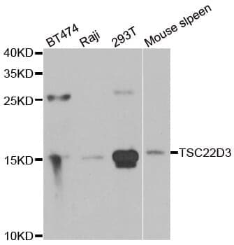 Anti-TSC22D3 Antibody
