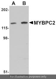 Anti-MYBPC2 Antibody
