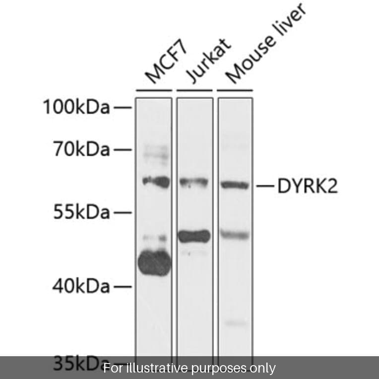 Anti-DYRK2 Antibody