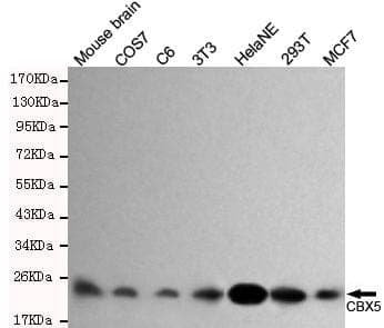 Anti-CBX5 Antibody