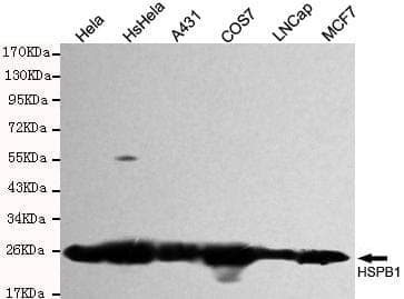 Anti-HSP27 Antibody