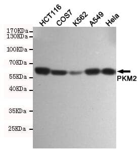 Anti-PKM2 (1F2) Antibody