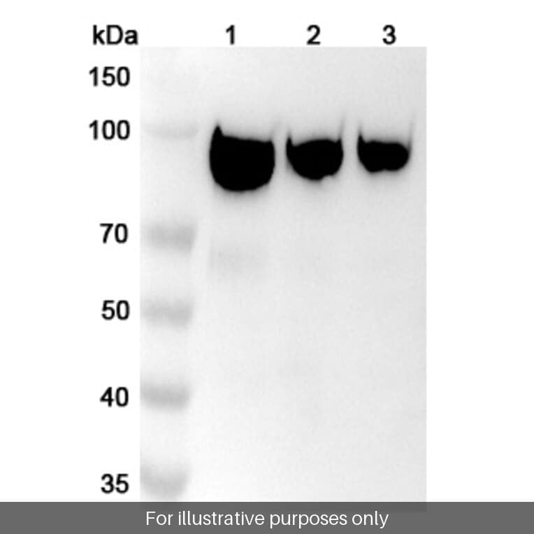 Anti-Neisseria gonorrhoeae Antibody