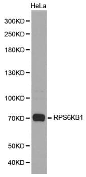 Anti-RPS6KB1 Antibody