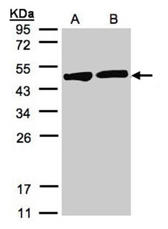Anti-Creatine Kinase BB Antibody