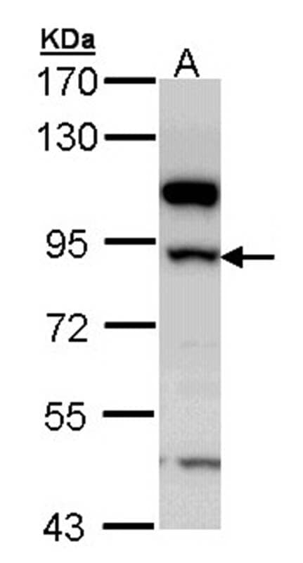 Anti-17beta-HSD4 Antibody