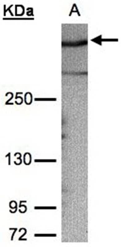 Anti-AKAP12 Antibody