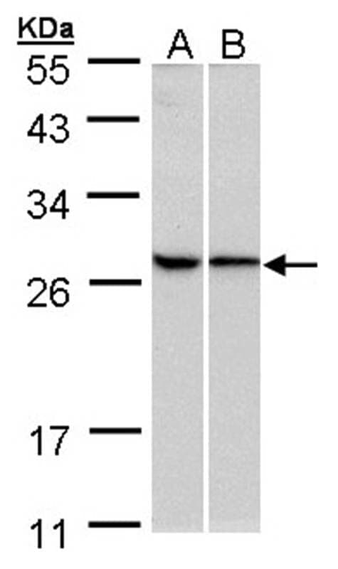 Anti-RPL13A Antibody