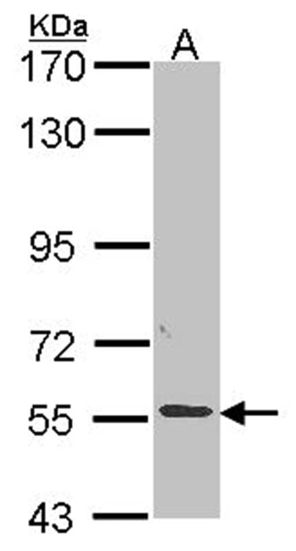 Anti-ALPPL2 Antibody