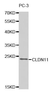 Anti-CLDN11 Antibody