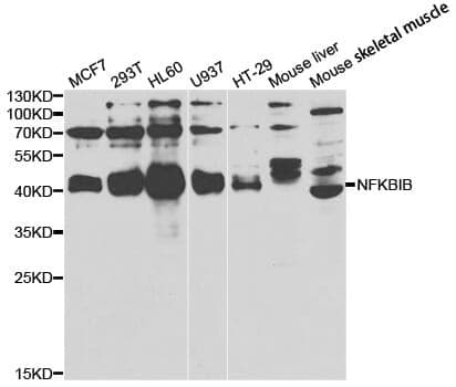 Anti-NFKBIB Antibody
