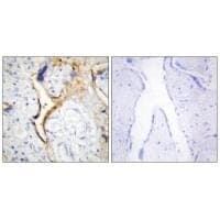 Anti-CKI-ε Antibody