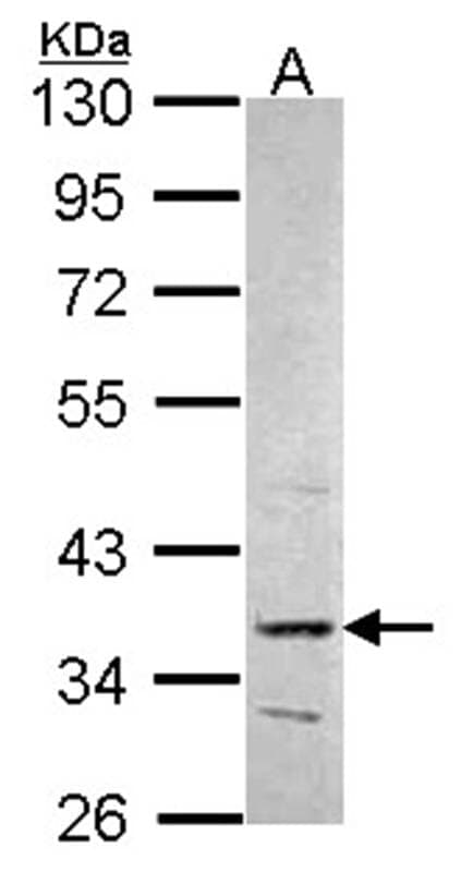 Anti-PRPS2 Antibody