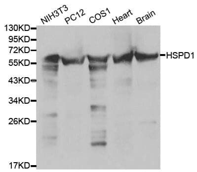 Anti-HSPD1 Antibody
