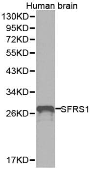 Anti-SFRS1 Antibody