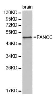 Anti-FANCC Antibody