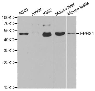 Anti-EPHX1 Antibody