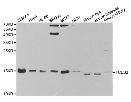 Anti-TCEB2 Antibody