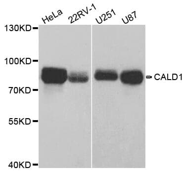 Anti-CALD1 Antibody