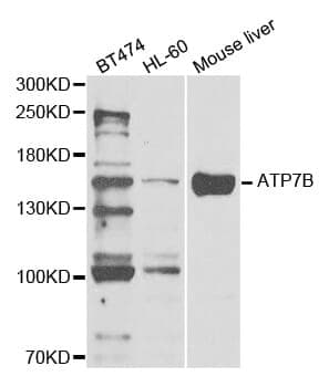 Anti-ATP7B Antibody