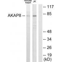Anti-AKAP8 Antibody