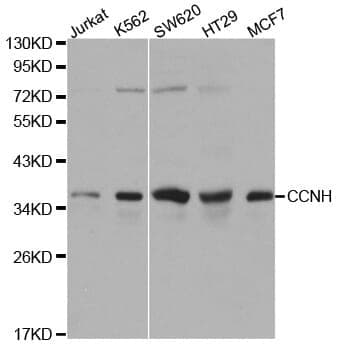 Anti-CCNH Antibody