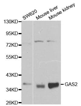 Anti-GAS2 Antibody