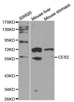 Anti-CES2 Antibody