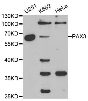 Anti-PAX3 Antibody