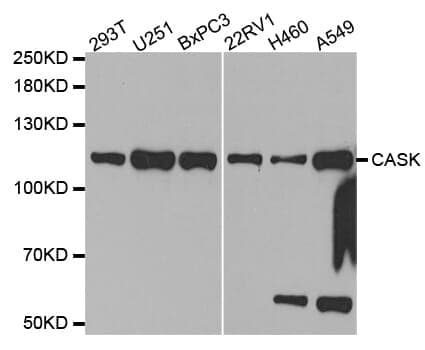 Anti-CASK Antibody