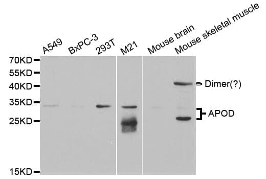 Anti-APOD Antibody