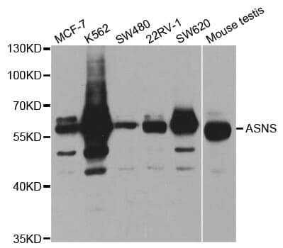 Anti-ASNS Antibody