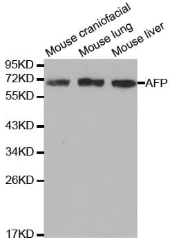 Anti-AFP Antibody