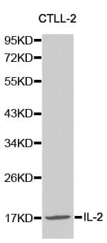 Anti-IL2 Antibody