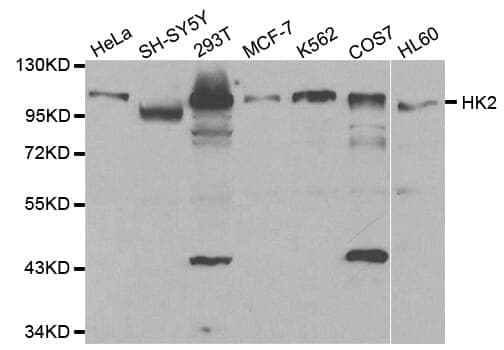 Anti-HK2 Antibody