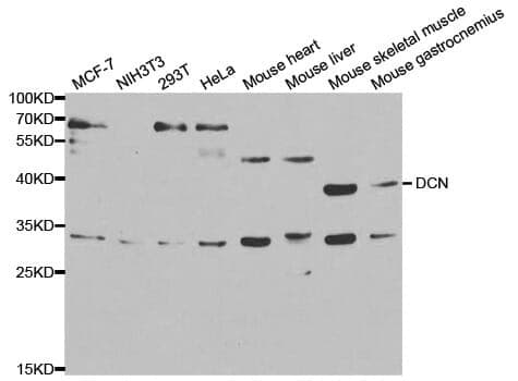 Anti-DCN Antibody