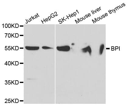 Anti-BPI Antibody