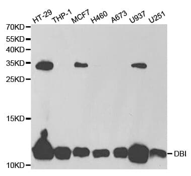 Anti-DBI Antibody