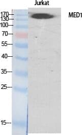 Anti-TRAP220 Antibody