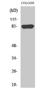 Anti-REP-2 Antibody